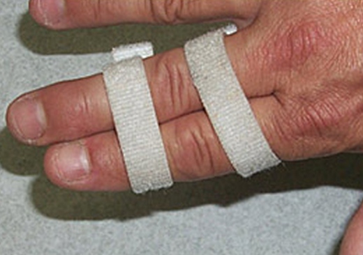 Buddy tape your injured finger