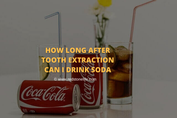 After A Tooth Extraction When Can I Drink Soda Find Out: How Long After Tooth Extraction Can I Drink Soda