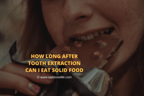 How Long After Tooth Extraction Can I Eat Solid Food : How Long After Tooth Extraction Can I Eat Solid Food : This is because solid food may increase the risks of dry socket or alveolar osteitis, infection, and other complications.