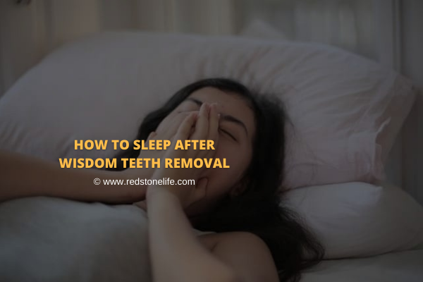 after wisdom teeth removal do i sleep with gauze
