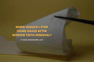 How Long Do You Wear Gauze After Wisdom Teeth Removal?
